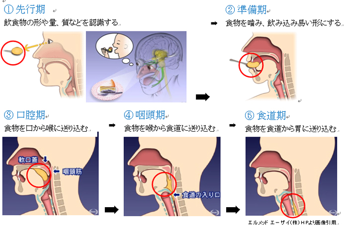 不 顕 性 誤 嚥 と は