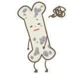 骨粗鬆症　その①