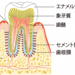 知覚過敏症