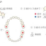 虫歯について