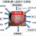 お口の乾燥