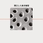 冷たい物に過敏