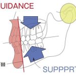 「 歯を守るための力のコントロール Ⅶ 」