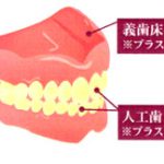 デンチャー・プラークについて