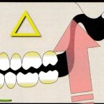 歯を守るための力のコントロール　Ⅹ
