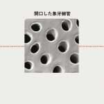 象牙質知覚過敏症