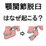 顎が外れたら、どうする？