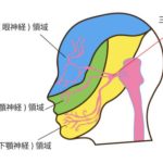三叉神経痛