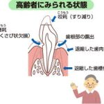 高齢者のお口の状態について